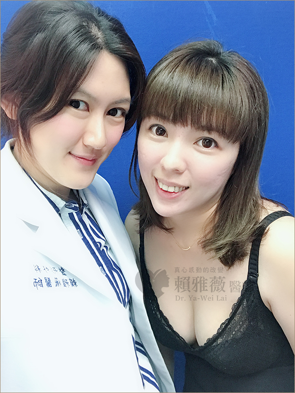 高雄自體脂肪隆乳案例